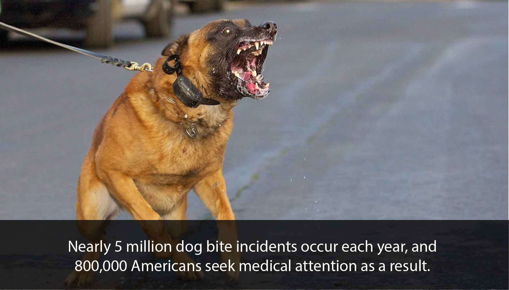 Dog Bites